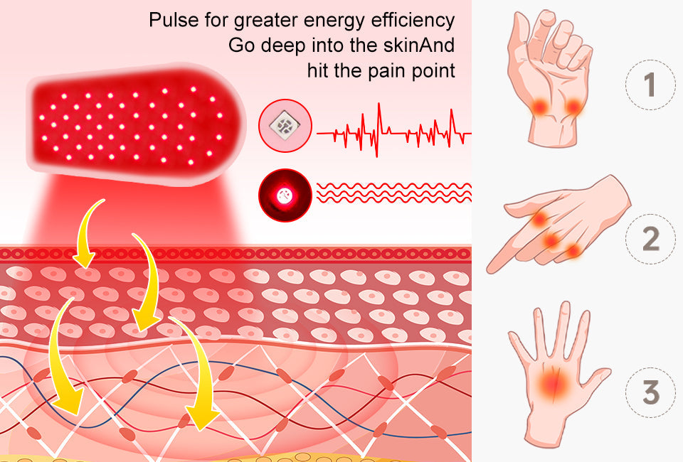 Red Light Therapy Beauty Glove