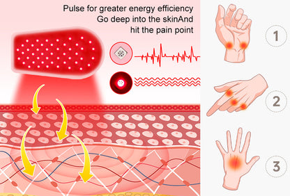 Red Light Therapy Beauty Glove